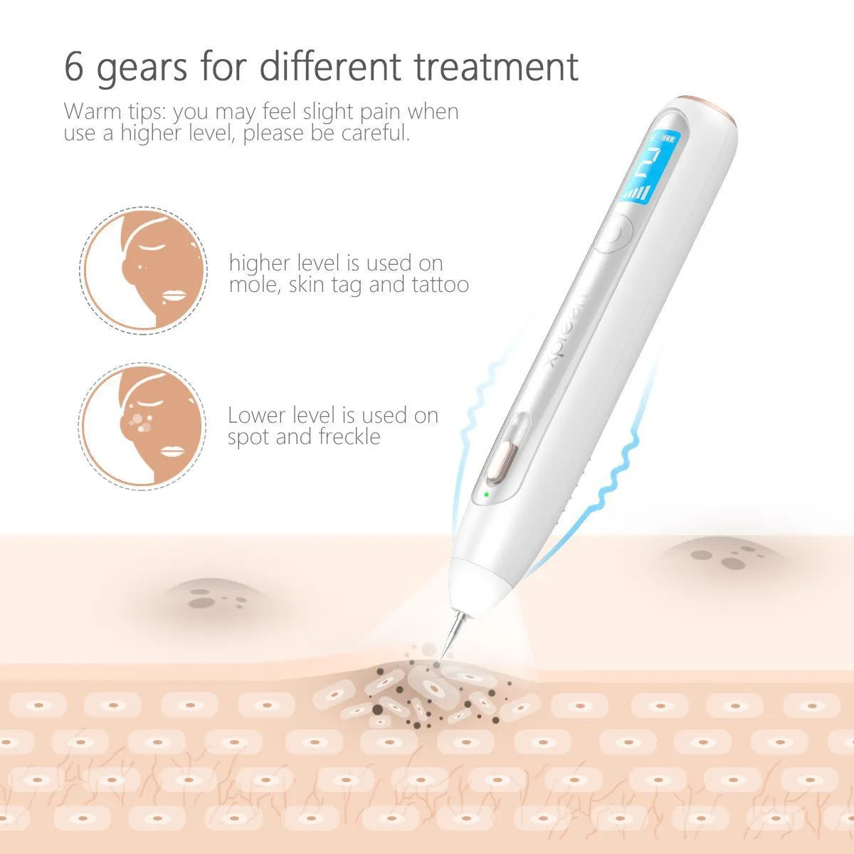 Advanced Plasma Pen Tattoo, Mole, Freckles and Skin Tag Eraser