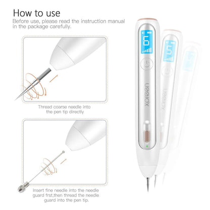 Advanced Plasma Pen Tattoo, Mole, Freckles and Skin Tag Eraser