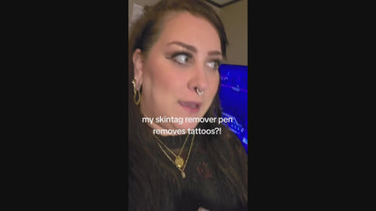 Advanced Plasma Pen Tattoo, Mole, Freckles and Skin Tag Eraser